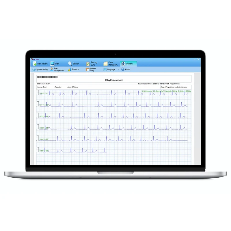 Système de gestion ECG