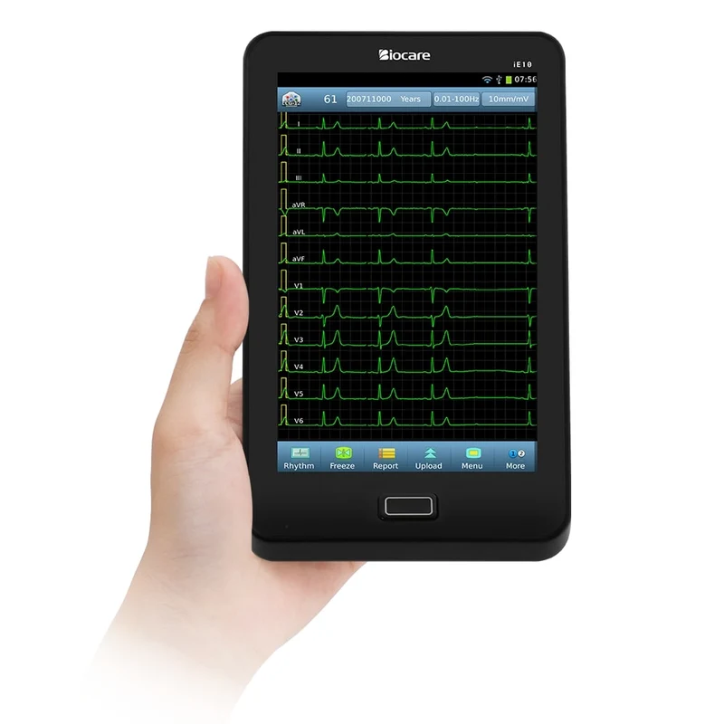 Tablette ECG 12 dérivations