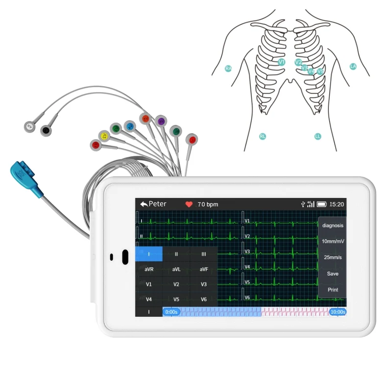 Appareil ECG de poche à 12 dérivations