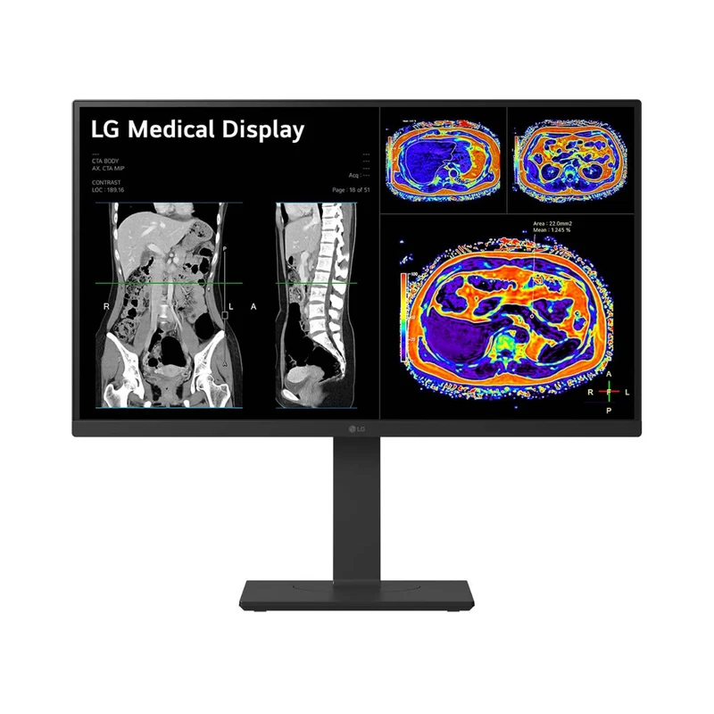LG Moniteur de revue clinique IPS 8MP 27 pouces