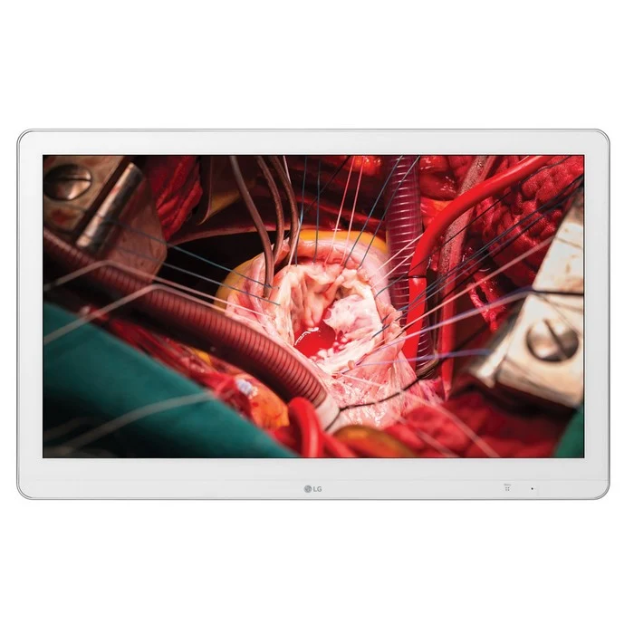 Moniteur chirurgical LG 27HK510S IPS Full HD