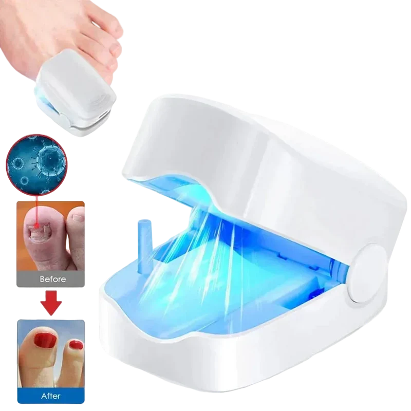 Appareil de Traitement au Laser pour Champignons des Ongles