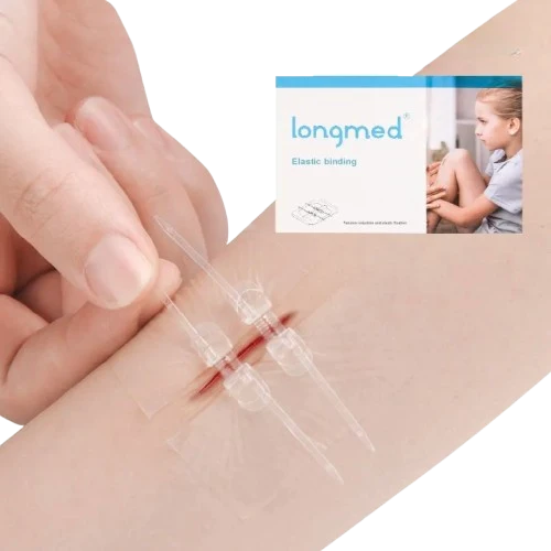 2x Pansements de Suture pour Plaie à Glissière