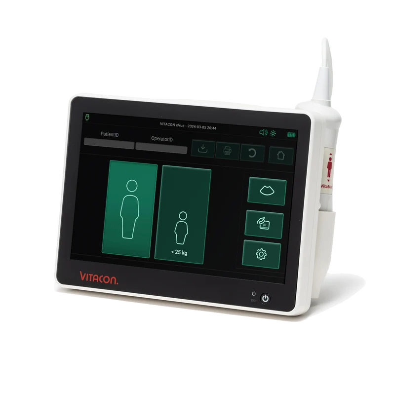 Bladder scanner VitaScan