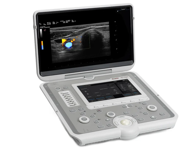Echographe MyLab™Sigma Esaote