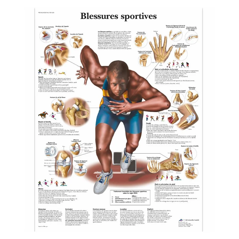 Planche anatomique Blessures sportives - 3B Scientific