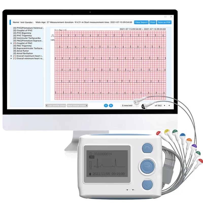 Wellue 12-Lead ECG Holter Monitor