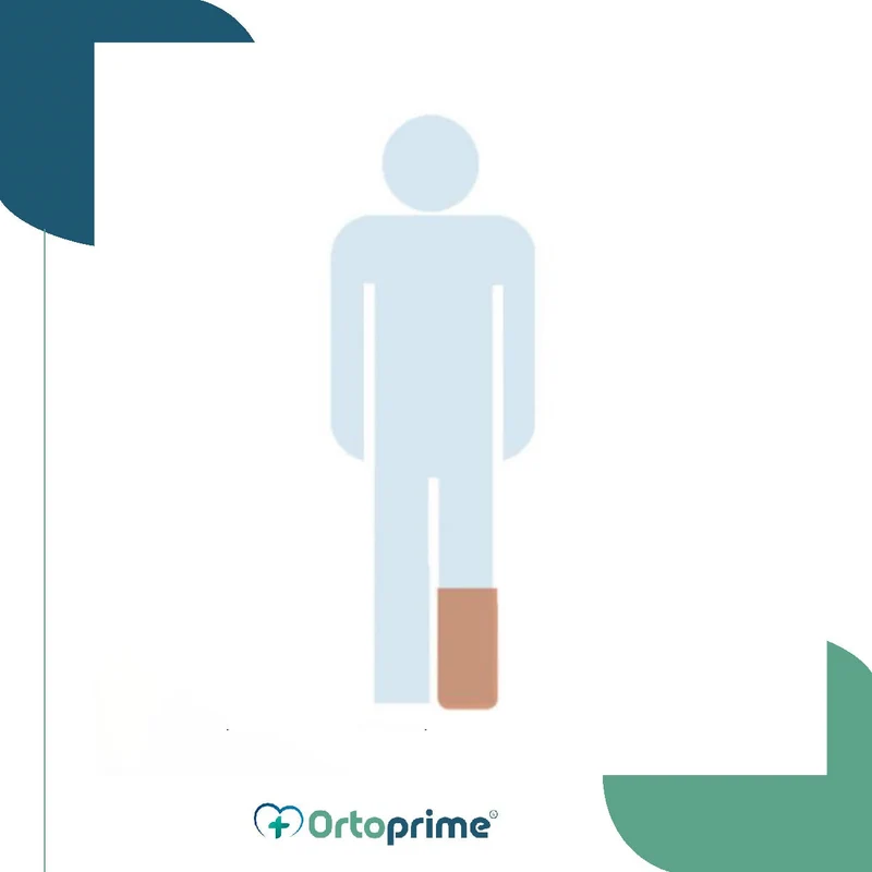 Protège-plâtre pour Demi-Jambe | Anatomique et Réutilisable