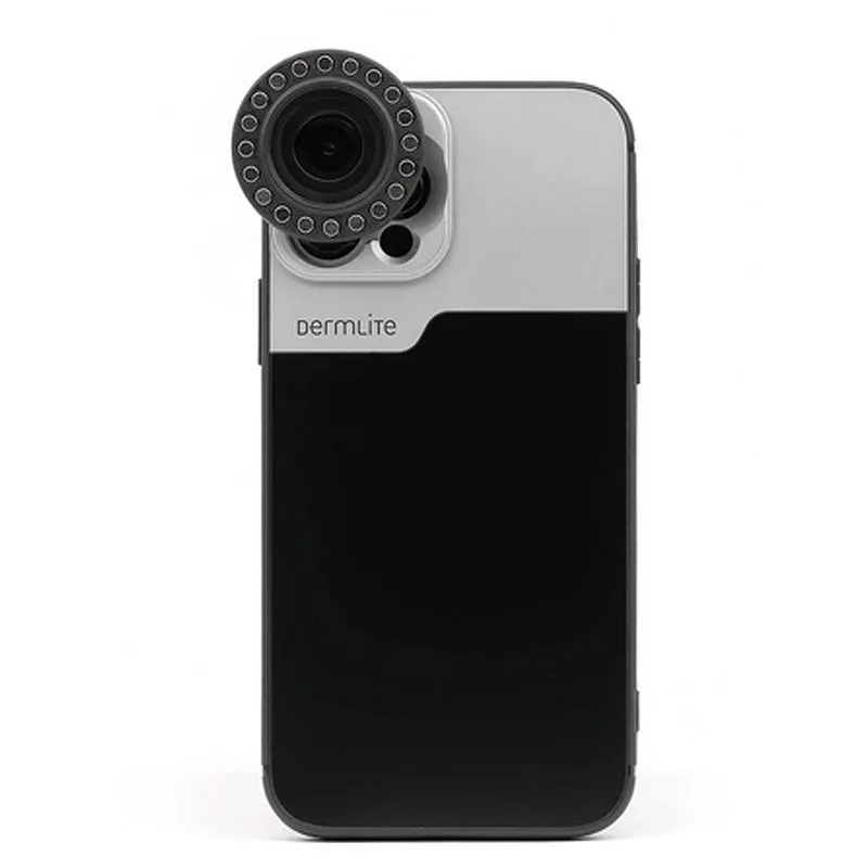 DermLite - Coque de connexion pour iPhone 16, 17 & 18